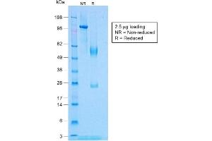 SDS-PAGE Analysis Purified TNF alpha Rabbit Recombinant Monoclonal Antibody (TNF/1500R). (Recombinant TNF alpha anticorps)