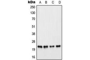 Western blot analysis of PARP1 expression in HeLa PMA-treated (A), Raw264. (PARP1 anticorps  (Center))