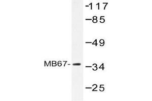 Western blot (WB) analysis of MB67 antibody in extracts from Jurkat cells. (NR1I3 anticorps)