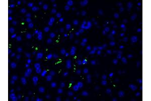 ABIN6261455 and ABIN6277691 at 1/200 staining human liver tissue cells by ICC/IF. (Ephrin B2 anticorps  (C-Term))
