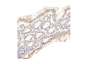 Immunohistochemistry of paraffin embedded rat colon using USP13 (ABIN7076106) at dilution of 1:700 (400x lens) (USP13 anticorps)