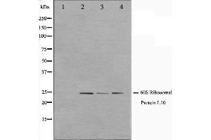 Western blot analysis on K562,Jurkat and 293 cell lysate using RPL10 Antibody. (RPL10 anticorps  (N-Term))