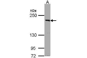 WB Image Sample (30μg whole cell lysate) A:Raji , 5% SDS PAGE antibody diluted at 1:1000 (PASK anticorps  (C-Term))