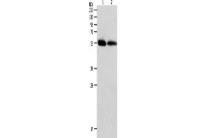Western Blotting (WB) image for anti-Matrix Metallopeptidase 11 (Stromelysin 3) (MMP11) antibody (ABIN2426224) (MMP11 anticorps)