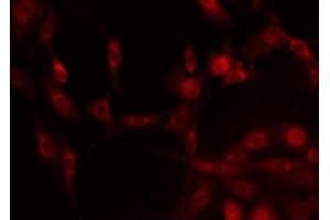 ABIN6275270 staining HepG2 by IF/ICC. (NDUFA4L2 anticorps  (C-Term))