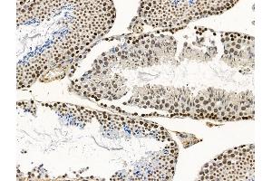 CCDC28A Antibody at 1/100 staining Mouse testis tissue by IHC-P. (CCDC28A anticorps  (Internal Region))