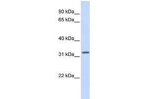 WB Suggested Anti-APTX Antibody Titration:  0. (Aprataxin anticorps  (Middle Region))