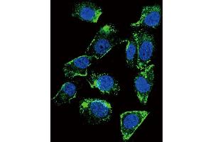 Confocal immunofluorescent analysis of BTC Antibody (N-term) (ABIN655615 and ABIN2845096) with MDA-M cell followed by Alexa Fluor 488-conjugated goat anti-rabbit lgG (green).