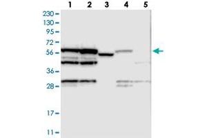 Western blot analysis of Lane 1: RT-4, Lane 2: U-251 MG, Lane 3: Human Plasma, Lane 4: Liver, Lane 5: Tonsil with MPP6 polyclonal antibody . (MPP6 anticorps)