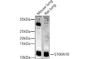 Western blot analysis of extracts of various cell lines, using S100 antibody (ABIN3015803, ABIN3015804, ABIN3015805, ABIN1682607 and ABIN6219148) at 1:400 dilution.