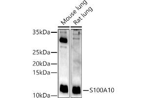 Western blot analysis of extracts of various cell lines, using S100 antibody (ABIN3015803, ABIN3015804, ABIN3015805, ABIN1682607 and ABIN6219148) at 1:400 dilution. (S100A10 anticorps  (AA 1-97))