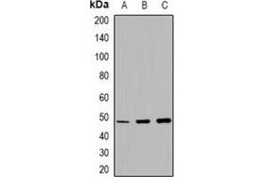 Western blot analysis of MMP13 expression in DLD1 (A), rat lung (B), rat testis (C) whole cell lysates. (MMP13 anticorps)