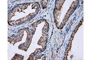 Immunohistochemical staining of paraffin-embedded prostate tissue using anti-PRKAR2A mouse monoclonal antibody.