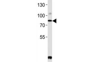 Western blot analysis of lysate from SW480 cell line using PCSK9 antibody.