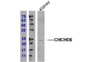 Lane 1: (mouse)Kidney lysates, probed with CHCHD6 Polyclonal Antibody, Unconjugated (Catalog # at 1:300 overnight at 4˚C. (CHCHD6 anticorps  (AA 135-235))