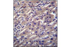 Immunohistochemistry analysis in Formalin Fixed, Paraffin Embedded Human liver tissue stained with SCP2 Antibody (N-term) followed by peroxidase conjugation of the secondary antibody and DAB staining. (SCP2 anticorps  (N-Term))
