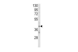 Western blot analysis of KIR2DL4 Antibody (C-term) (ABIN652985 and ABIN2842625) in MDA-M cell line lysates (35 μg/lane).