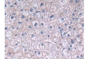 Detection of FADS2 in Human Liver Tissue using Polyclonal Antibody to Fatty Acid Desaturase 2 (FADS2)