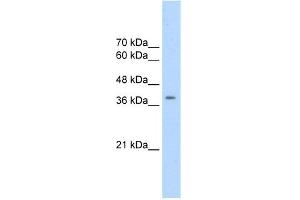 WB Suggested Anti-CDK9 Antibody   Titration: 2. (CDK9 anticorps  (N-Term))