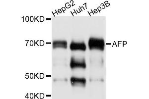 Western blot analysis of extracts of various cell lines, using AFP antibody (ABIN4902853). (alpha Fetoprotein anticorps)