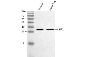 Western blot analysis of Prolactin/PRL using anti-Prolactin/PRL antibody (ABIN7601464).