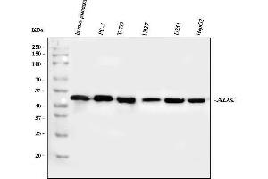 Western blot analysis of ADK using anti-ADK antibody (ABIN4886430). (ADK anticorps  (AA 165-351))