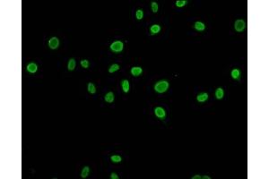 Immunofluorescence staining of Hela cells (treated with 30mM sodium butyrate for 4h) with ABIN7139198 at 1:5, counter-stained with DAPI.