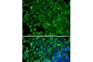 Immunofluorescence analysis of HeLa cells using ARRB2 Polyclonal Antibody (Arrestin 3 anticorps)