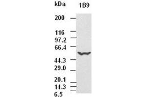 CK8 antibody (1B9) at 1:5000 dilution + Hela cell lysate (KRT8 anticorps  (AA 91-381))