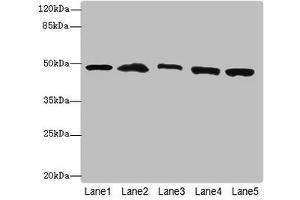 Western blot All lanes: PSMD13antibody at 3. (PSMD13 anticorps  (Regulatory Subunit 13))