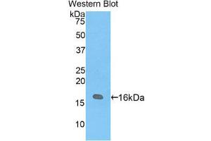 Western Blotting (WB) image for anti-Vasoactive Intestinal Peptide (Vip) (AA 34-157) antibody (ABIN1860940) (Vip anticorps  (AA 34-157))