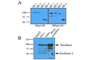 Western Blotting (WB) image for anti-Hexokinase 1 (HK1) (AA 1-917), (N-Term) antibody (ABIN317095) (Hexokinase 1 anticorps  (N-Term))