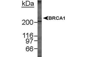 Western blot analysis of BRCA1 in MCF-7 whole cell lysate using BRCA1 monoclonal antibody, clone MU .