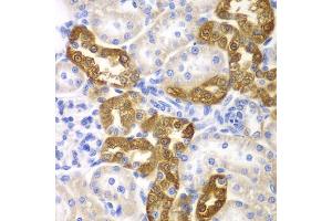 Immunohistochemistry of paraffin-embedded rat kidney using CD151 antibody (ABIN3023660, ABIN3023661, ABIN3023662, ABIN1679069 and ABIN6219074) at dilution of 1:200 (40x lens).