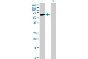 Western Blot analysis of JRK expression in transfected 293T cell line by JRK MaxPab polyclonal antibody. (JRK anticorps  (AA 1-568))