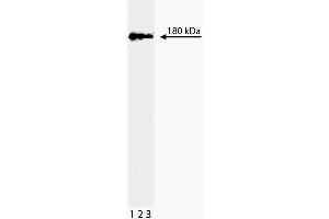 Western blot analysis of Topo IIbeta on a Jurkat lysate. (TOP2B anticorps  (AA 1281-1494))