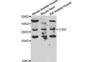 Western blot analysis of extracts of various cell lines, using TOB2 antibody. (TOB2 anticorps)
