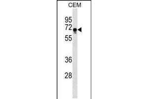 Western blot analysis in CEM cell line lysates (35ug/lane). (FEM1C anticorps  (C-Term))