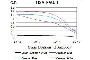 Black line: Control Antigen (100 ng), Purple line: Antigen(10 ng), Blue line: Antigen (50 ng), Red line: Antigen (100 ng), (DNAL4 anticorps  (AA 1-105))
