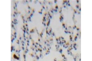 Used in DAB staining on fromalin fixed paraffin-embedded Lung tissue (CCL2 anticorps  (AA 1-99))