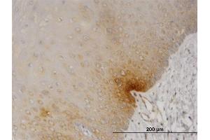 Immunoperoxidase of monoclonal antibody to DYRK2 on formalin-fixed paraffin-embedded human esophagus.