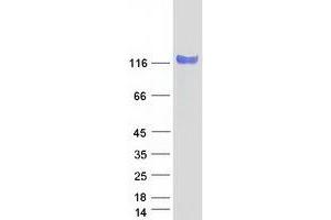 Validation with Western Blot