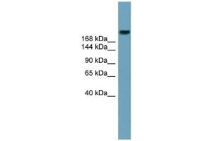 Human Stomach; WB Suggested Anti-ABCA12 Antibody Titration: 0. (ABCA12 anticorps  (Middle Region))