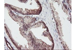 Image no. 12 for anti-Aminoacylase 1 (ACY1) antibody (ABIN1496455) (Aminoacylase 1 anticorps)