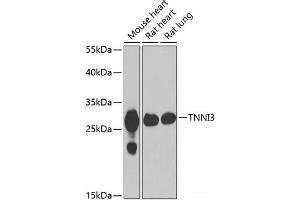 Western blot analysis of extracts of various cell lines using TNNI3 Polyclonal Antibody at dilution of 1:1000. (TNNI3 anticorps)