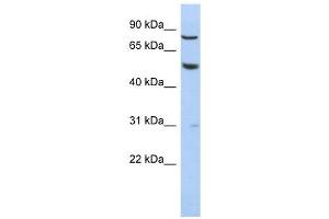 GPR56 antibody used at 1 ug/ml to detect target protein.