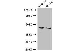 Western Blot Positive WB detected in: Mouse kidney tissue, Mouse brain tissue All lanes: GDF11 antibody at 3 μg/mL Secondary Goat polyclonal to rabbit IgG at 1/50000 dilution Predicted band size: 46 kDa Observed band size: 46 kDa (GDF11 anticorps  (AA 296-404))