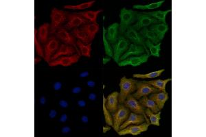ABIN6264024 and ABIN6279643 staining Hela cells by IF/ICC. (PALLD anticorps  (Internal Region))