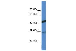 WB Suggested Anti-Dgat2 Antibody Titration: 1. (DGAT2 anticorps  (C-Term))