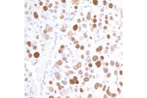 Immunohistochemistry (IHC) image for anti-Importin Subunit alpha-1 (KPNA2) (C-Term) antibody (ABIN7453571) (Importin Subunit alpha-1 (KPNA2) (C-Term) anticorps)